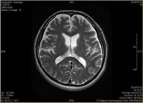 2319－頭部MRI